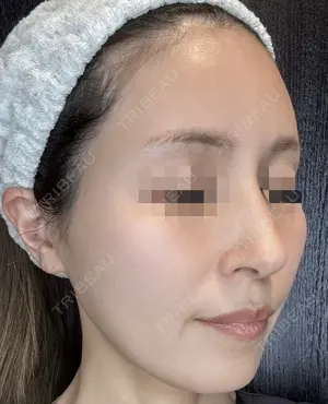 null days after image