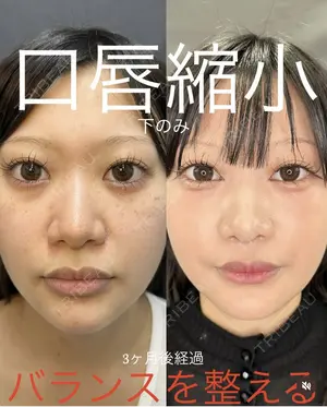 null days after image