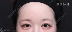 90 days after image