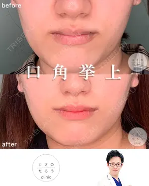 null days after image