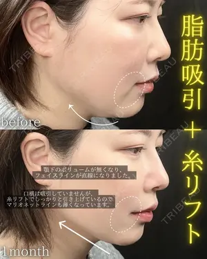 30 days after image