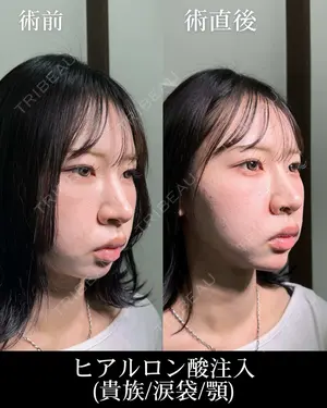 null days after image