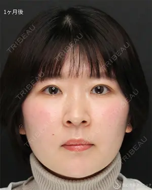 30 days after image