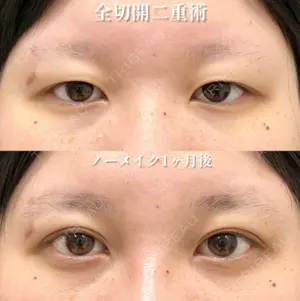 before image