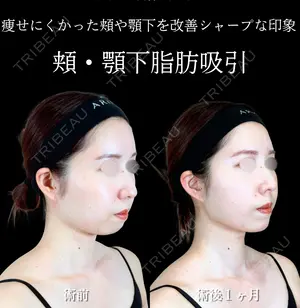 30 days after image