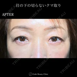 30 days after image