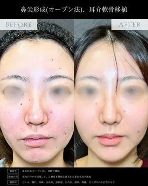 null days after image