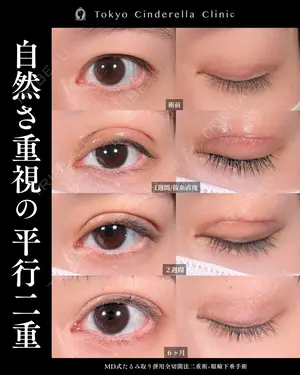 180 days after image