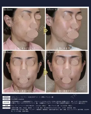 30 days after image