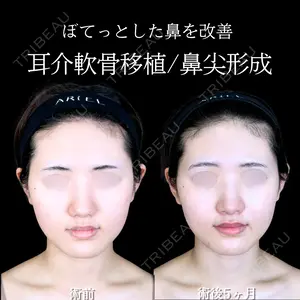150 days after image