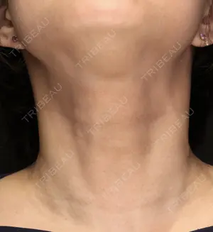 60 days after image
