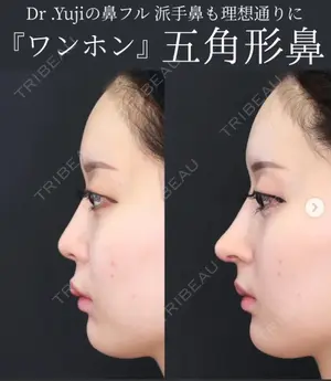 30 days after image