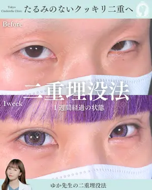 before image