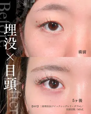 150 days after image