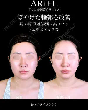 180 days after image