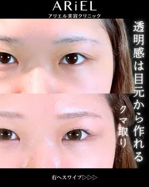 30 days after image