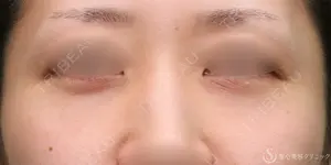 425 days after image