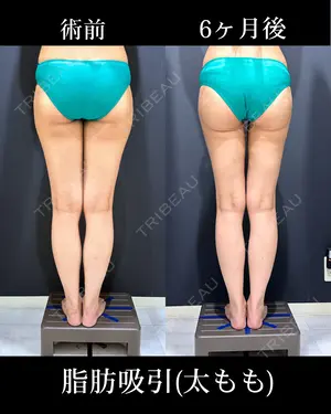 180 days after image