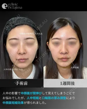 7 days after image