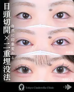 30 days after image
