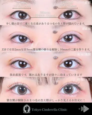 before image