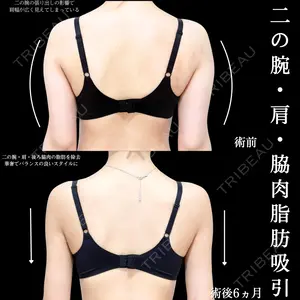 180 days after image