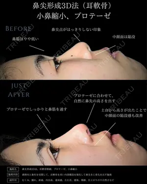 null days after image