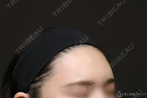 240 days after image