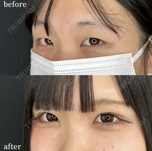 null days after image