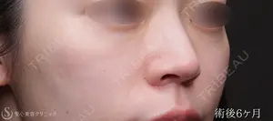 180 days after image