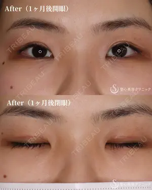 30 days after image