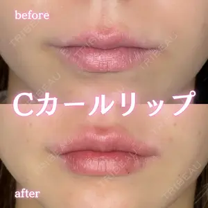 before image
