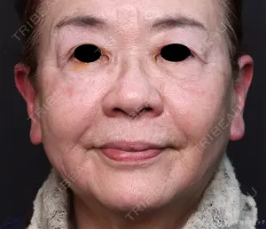 1825 days after image