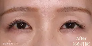 180 days after image