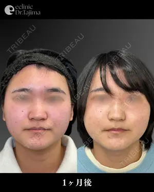 30 days after image
