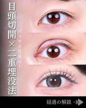 150 days after image