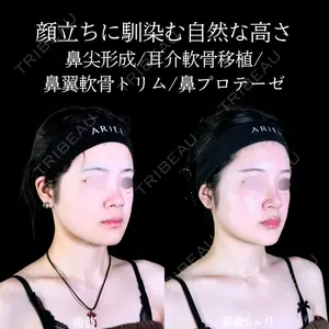 180 days after image