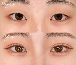 null days after image