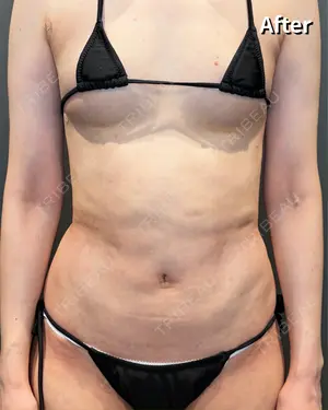 30 days after image