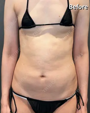 before image
