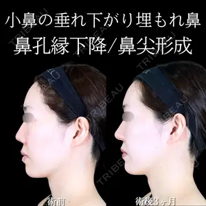 90 days after image