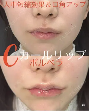 null days after image