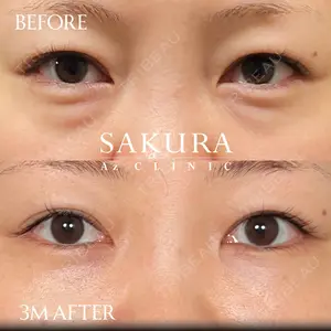 90 days after image