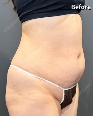 before image