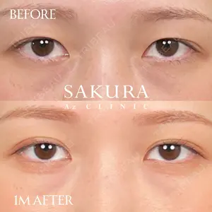30 days after image
