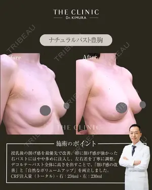 null days after image