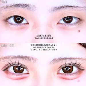 before image