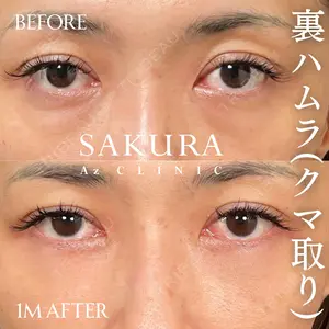 before image