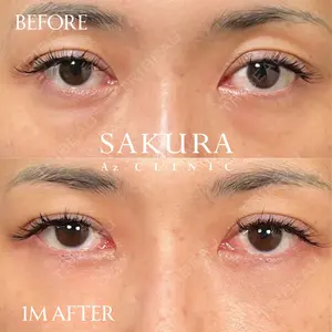30 days after image