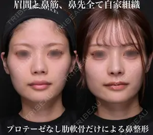 180 days after image